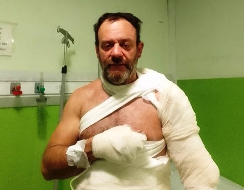 El Bolsón: Después del violento robo en el Kumelen Pablo Conti dice que se vuelven a Buenos Aires