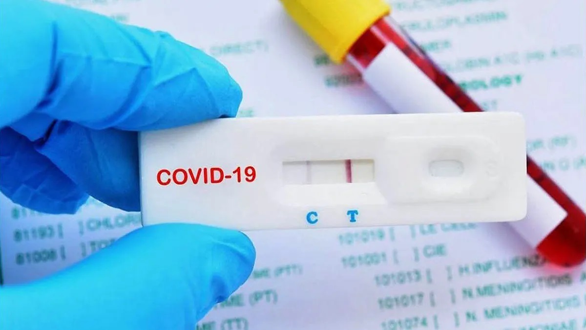 Covid-19: Salud insta a mantener las medidas de prevención y la vacunación
